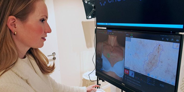 neue-wege-in-der-vorsorge:-hautkrebs-check-mit-ki-und-ferndiagnose