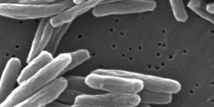 keime-schnell-identifiziert:-krankheitserreger-in-minuten-statt-tagen-erkennen