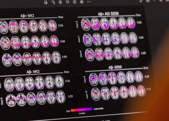 eu-kommission-laesst-neuartigen-alzheimer-wirkstoff-lecanemab-zu
