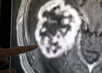 ki-modell-erkennt-mehr-als-170-krebsarten