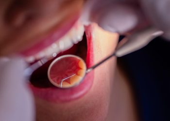 studie-zur-mundgesundheit:-karies-in-deutschland-geht-zurueck