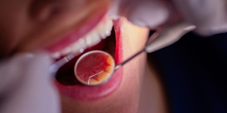 studie-zur-mundgesundheit:-karies-in-deutschland-geht-zurueck