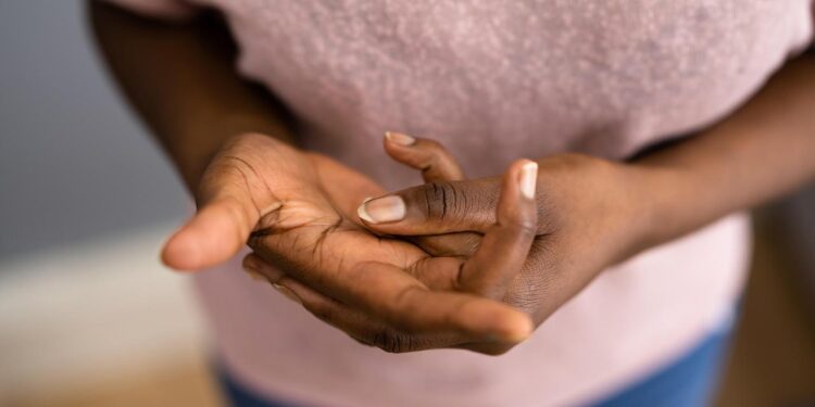 melanom:-hautkrebs-auf-dunkler-haut-wird-spaeter-entdeckt