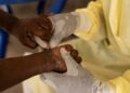 neue-mpox-variante-breitet-sich-in-zentralafrika-aus