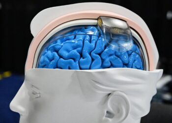 chip-im-kopf:-mit-hightech-gegen-laehmungen